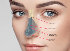 Thin skin in  rhinoplasty