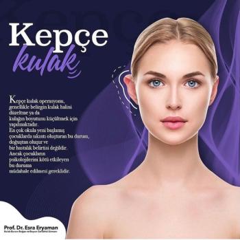 Small tips for otoplasty ...