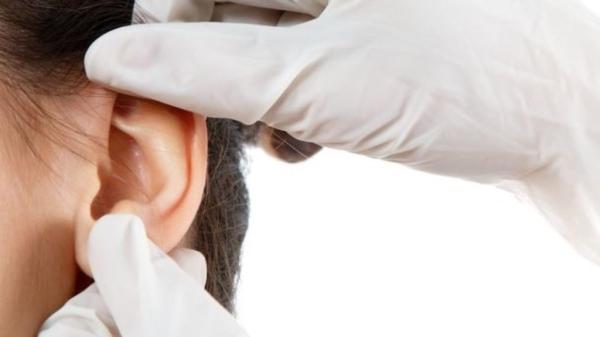 Techniques of otoplasty