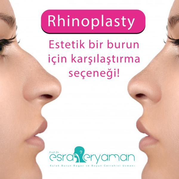 Pinch (Mandal ile Sıkılmış) Burun Deformitesi